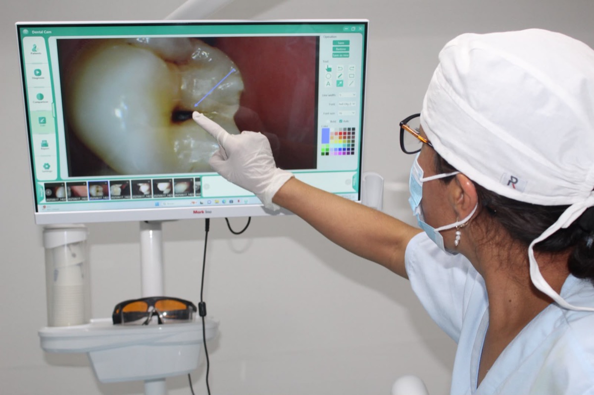 Explicando el diagnóstico con cámara intraoral